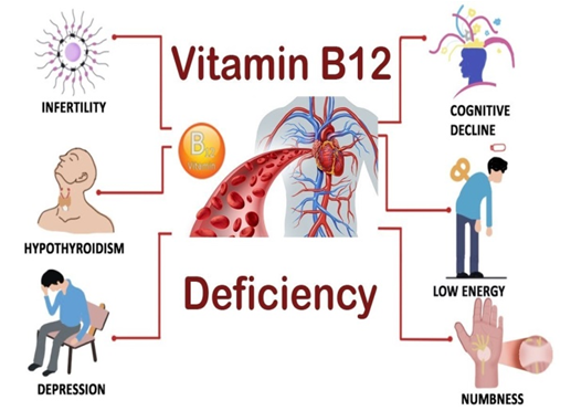 vitamin b12 deficiency