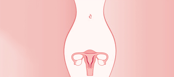 menstruation disorders
