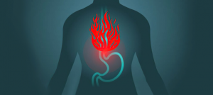 heart-burn-blog-featured-image