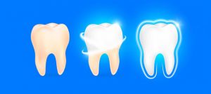 yellow turning into white teeth