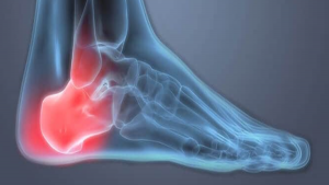 heel-pain-blog