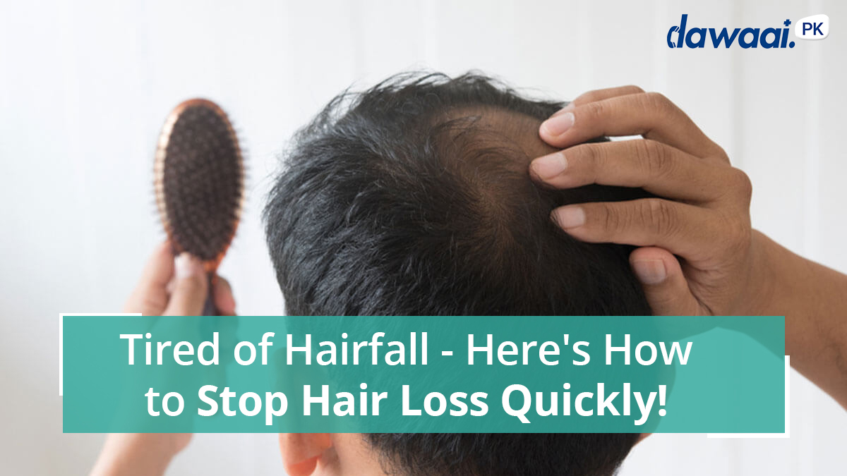 Hair Loss Treatment in Pakistan - Stop hair loss | Dawaai Blog