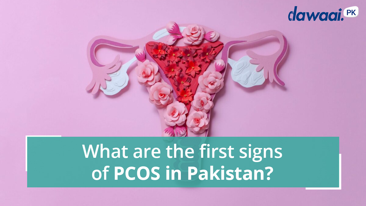 PCOS in Pakistan