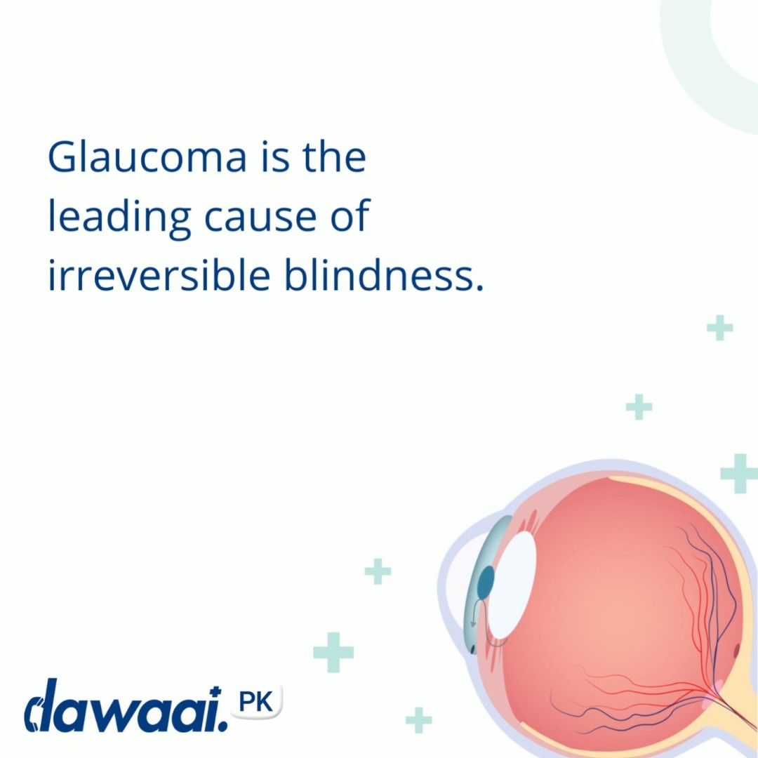 #Glaucoma, also referred to as the "silent blinder," is the leading cause of blindness in Pakistan. Early detection can save your sight!
With #Dawaai, book a priority in-clinic appointment now with Karachi's top Eye Specialist Dr. Mehnaz Shah at The Eye Center Clinic. 
Copy the URL below:
https://bit.ly/3BXkYJb
Start your journey to a healthy vision!
#GlaucomaAwareness #eyespecialist #TheEyeCenter #DrMehnazShah